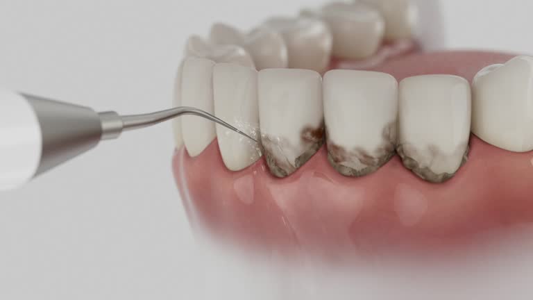 Trusted Dental Crowns And Bridges service in McAlmont, AR - Dentist Open Now